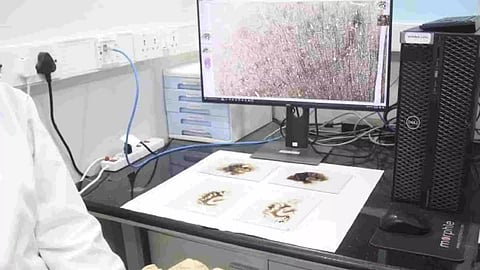 Representative Image