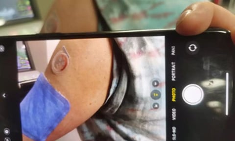 Representative Image (IANS)