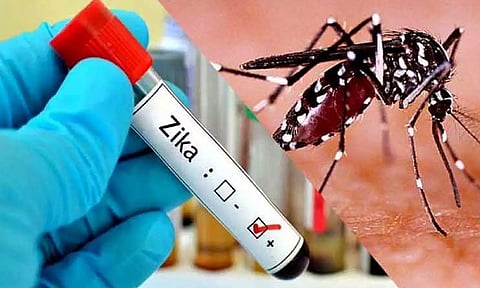 Representative image