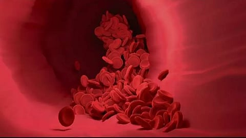 Representative image