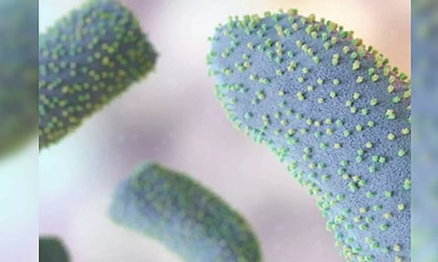 Representative Image