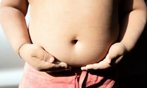 Representative image