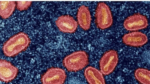 Representative Image