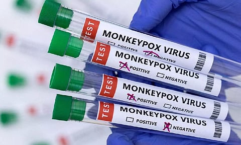 Representative Image