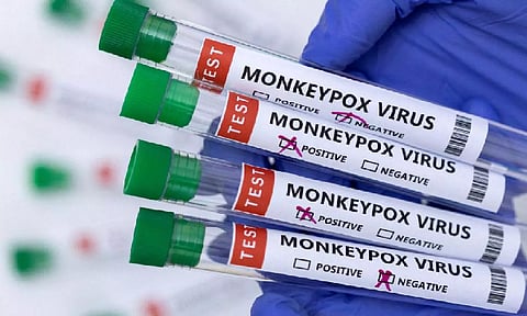 Representative Image