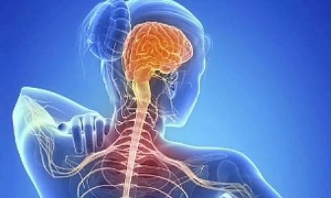 Representative image