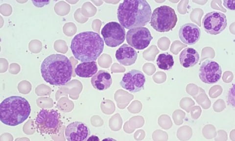 Representative Image (IANS)