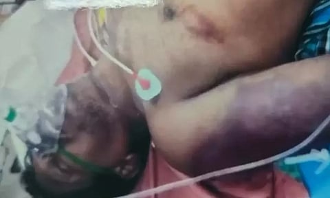 Prabhu, one of the accused in the case, at the hospital