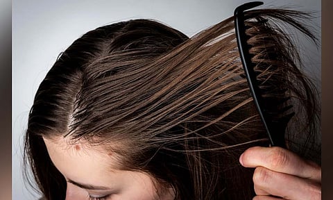 Representative image