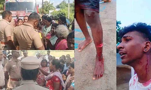 Another Nanguneri? Attack on youth in Tirunelveli raises concerns