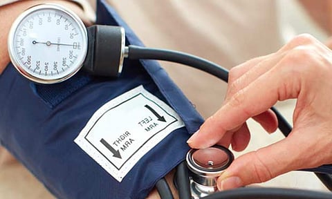 Representative Image