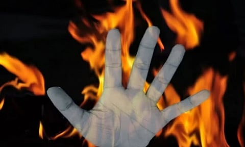 Representative image