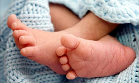 Representative Image