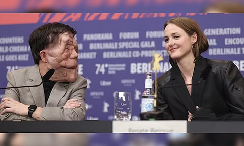 Actors Adam Pearson and Renate Reinsve attend the press conference of ‘A Different Man’ at the Berlinale