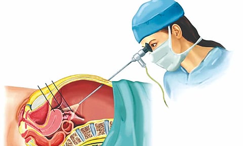 Representative Image