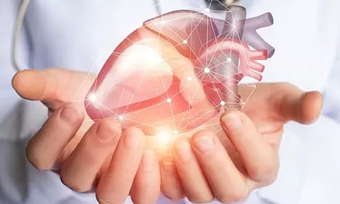 Representative image