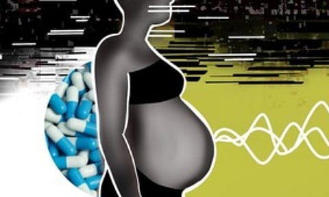 Representative image