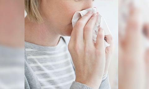 Representative image