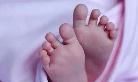 Representative Image 