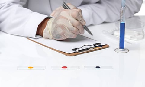 Representative Image (IANS)