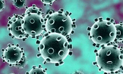 Representative Image