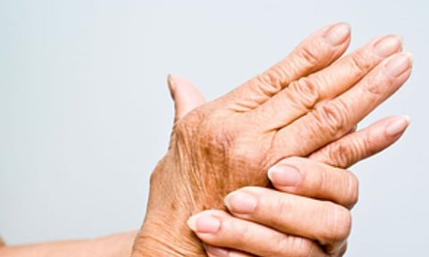 Representative Image