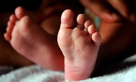 Representative image