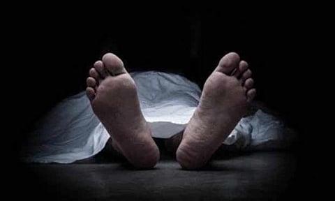 Representative Image