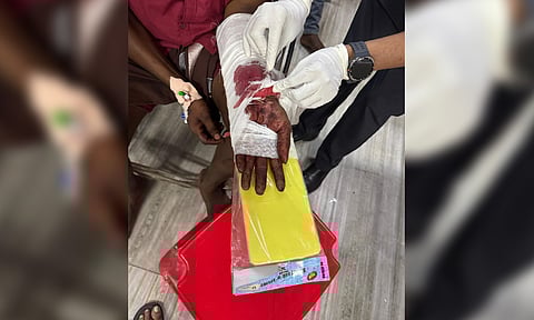 Doctors at the RGGGH performed an 8-hour surgery on a 29-year-old man to restore blood circulation in his left wrist