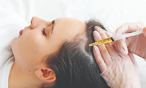 Representative image