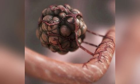 Representative Image (IANS)