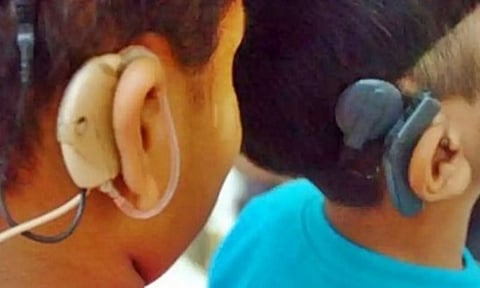 Representative Image