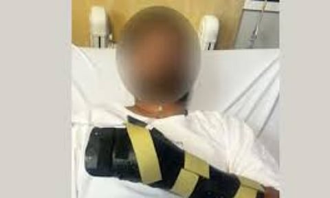 Indian-origin man was brutally attacked by a group of teenagers in Australia (Photo/X)