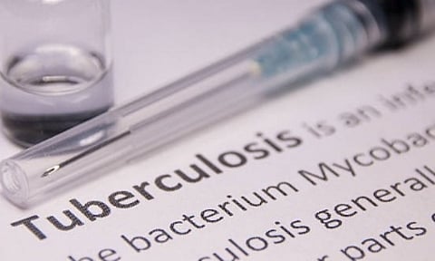 A portable device to detect tuberculosis (IANS)