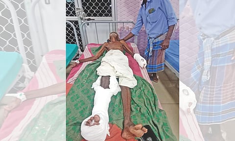 Kaliyaraj being treated at Thanjavur Medical College Hospital on Tuesday