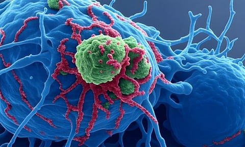 Immunotherapy drug has shown significant promise against aggressive cancers (IANS)