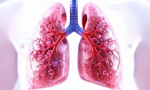 Antibody drug shows promise against lung cancer (IANS) 