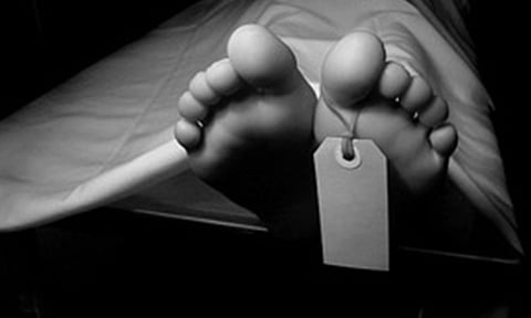 Representative Image