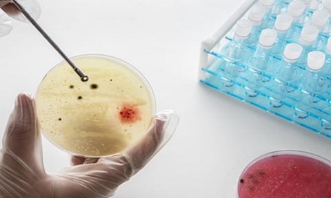 Targeted steroid against TB (IANS)