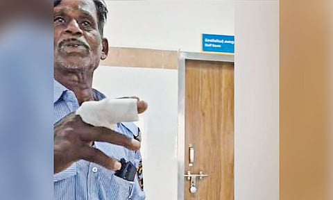 Attendant bites hospital guard's finger during quarrel in Tambaram
