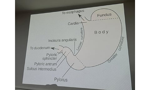 Representative image