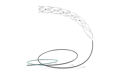 The Supernova Stent (IANS) 