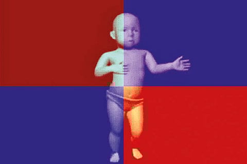 Representative Image