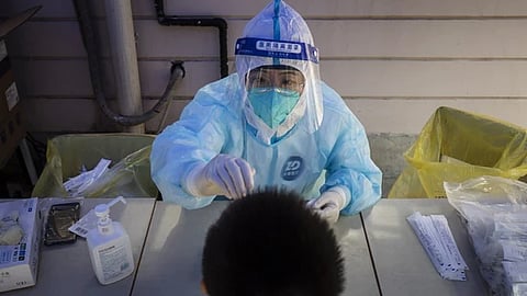 Representative image