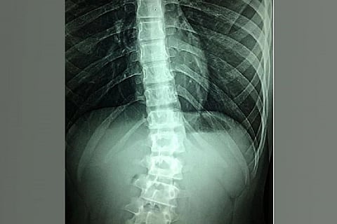 Representative image