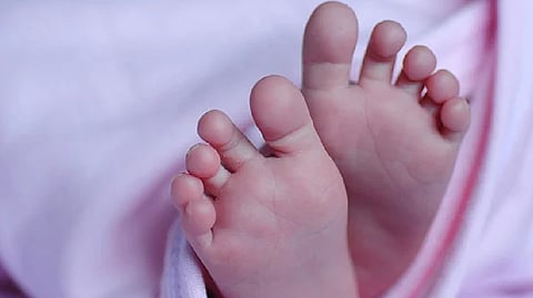 Representative image