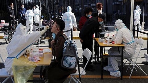 Representative image