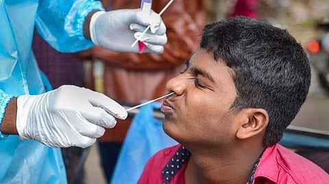 Representative image