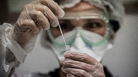 Representative Image