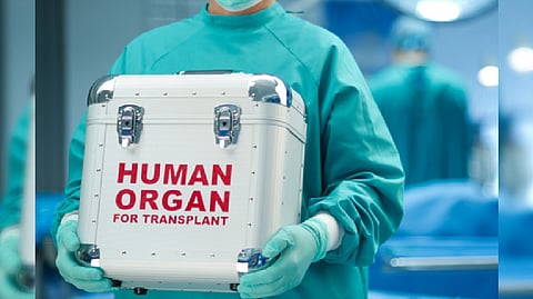 Representative image